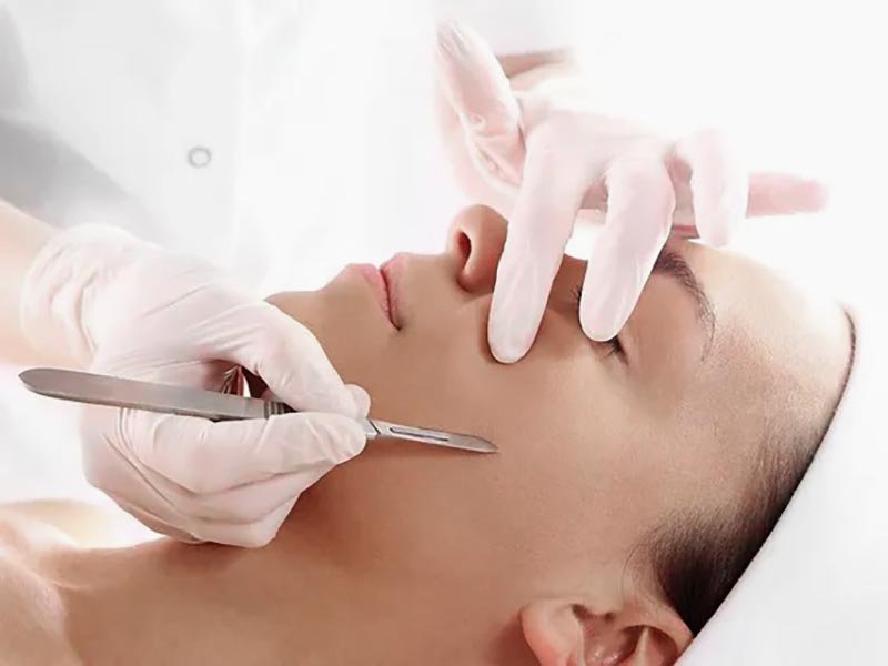 Dermaplaning remover células mortas e pelos finos do rosto